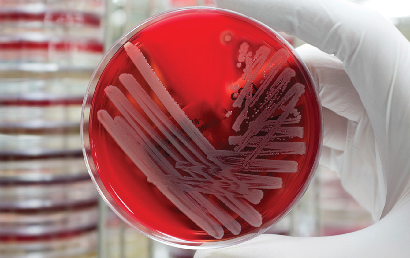 A petri dish