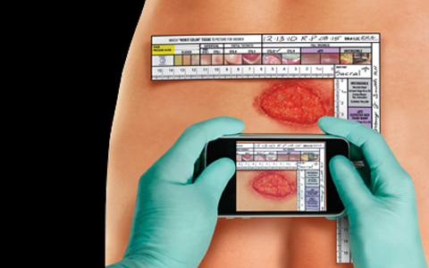 ne1-wound-assessment