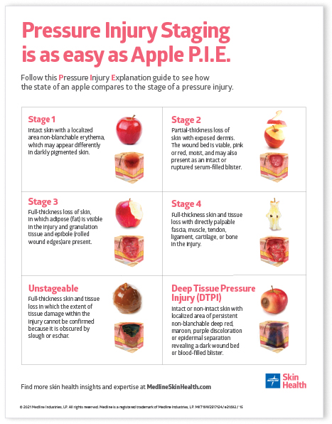 PST_SHD-May-Gated_Apple-Pie_RGB Hand holding apple to demonstrate wound staging printable poster.