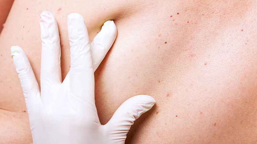 STK_SkinAssessment_RGB_840x473