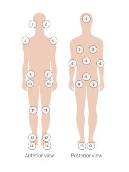Skin Assessment Diagram human body front and back.