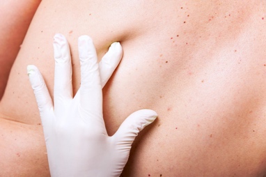 Pre- and Post-Surgery Wound Care_R6