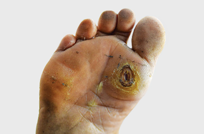 STK_Diabetic Foot Ulcer_RGB