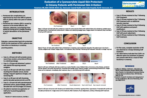 SAWC_3-posters_2