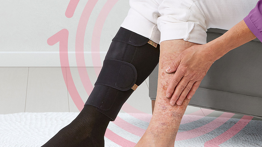 STK_SH_Venous-Leg-Ulcers_Compression_840x473_RGB