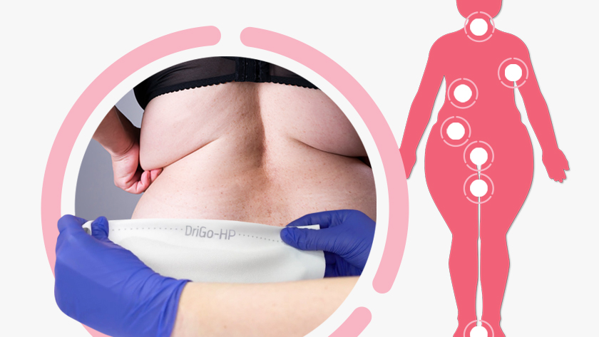 SHD_HydrogenPeroxide_skin-fold_840x473