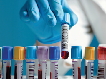 seamless-product-conversion Row of filled test tubes in a rack with a gloved clinician's hand lifting one out