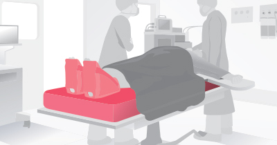 STK_Patient-jurney_OR_RGB Illustration of two clinicians standing on either side of a patient lying on a bed in an operating room