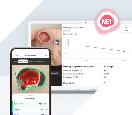 Images on smart phone screen and laptop of sample data from NE1 Wound Management System