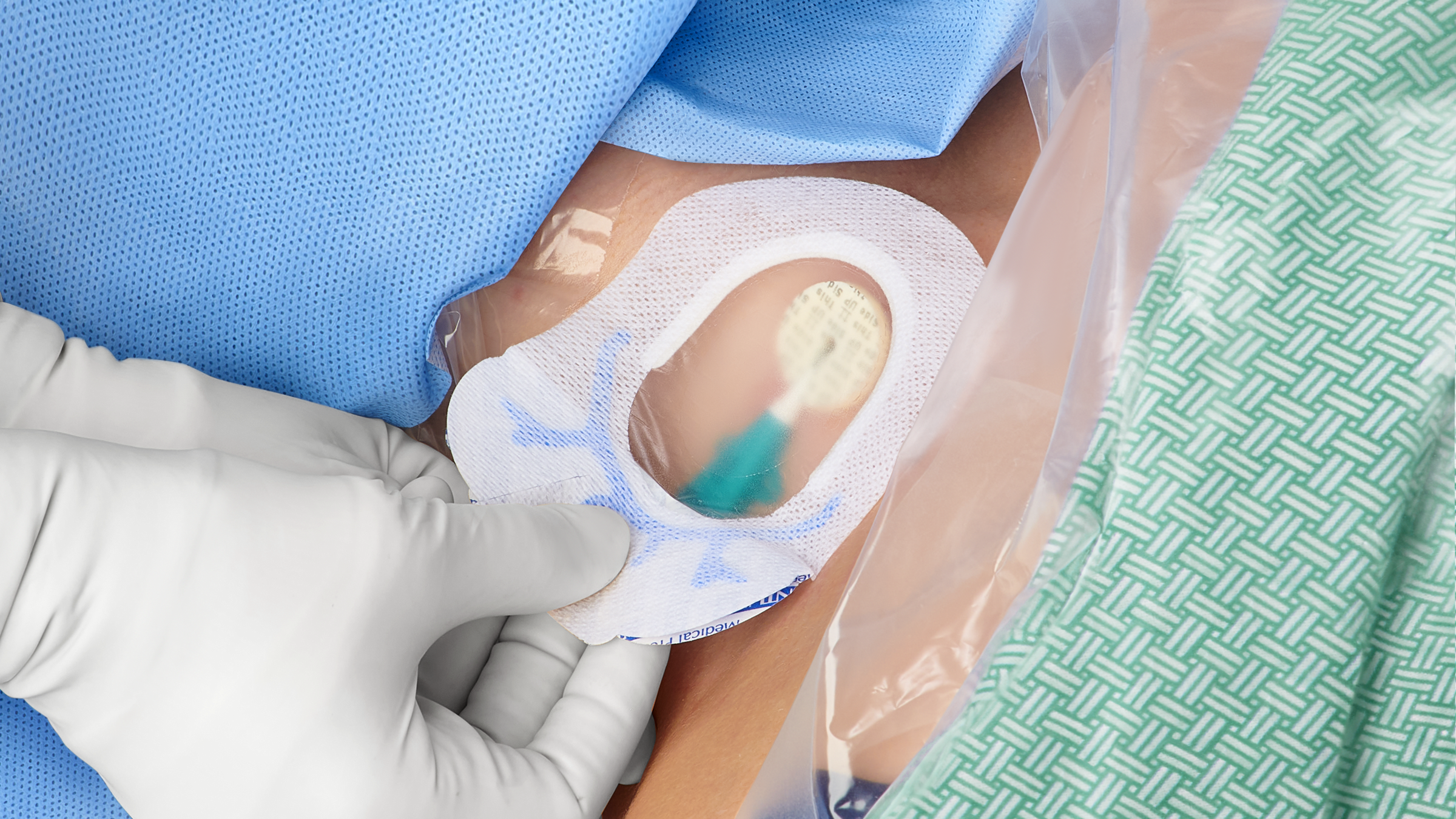 BAN_VAH_CVC dressing_article_04_RGB CVC Securement Device