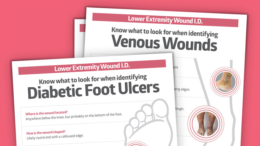 Lower extremity wound posters