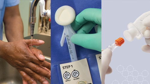 3 variations in catheter care