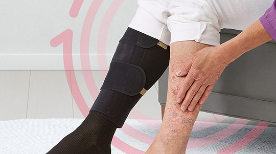 Lower legs of woman, one with compression garment