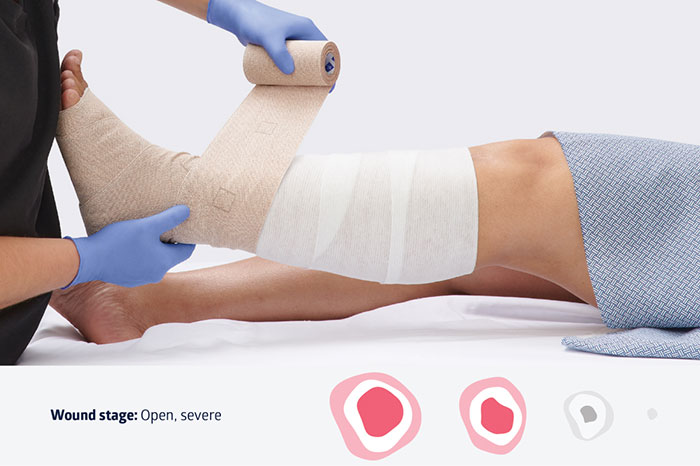 accuwrap-new