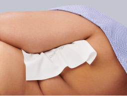 protects-five-days Patient with Remedy DriGo-HP sheet applied between arm and torso, which eliminates skin friction and skin to skin contact
