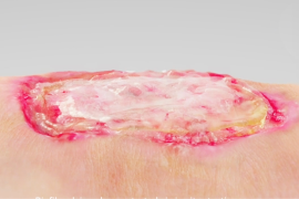 prevent-injury Close-up of simulated wound