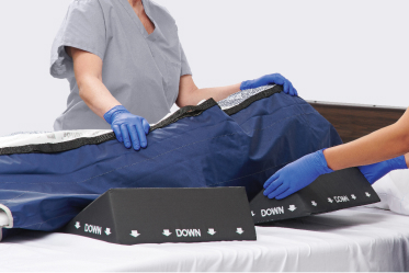 Gloved caregiver and bare leg of patient as caregiver dispenses foam on to cleansing cloth.