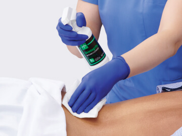 Clinician applies surfactant for removing debris in spray bottle to patient’s dermal wound 