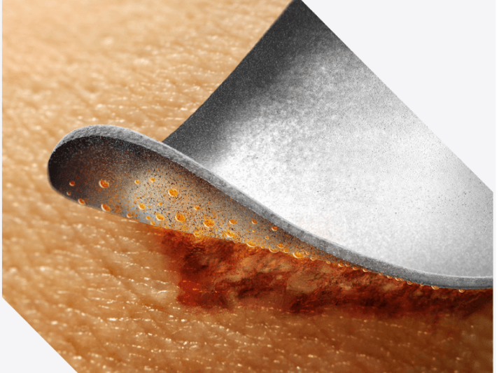 Clinician’s gloved hand applies Marathon XL to patient’s skin with wide applicator