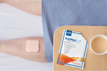 Clinician’s gloved hand applies dressing with antimicrobial agents to a wound with biofilm infection