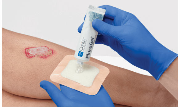 Clinician applies PluroGel, a product to advance the healing process in chronic wounds, to a wound dressing