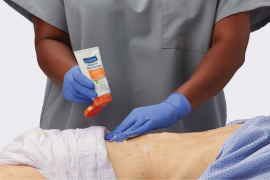 Clinician’s gloved hand applies dressing with antimicrobial agents to a wound with biofilm infection