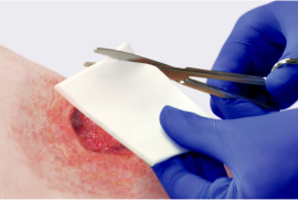 Clinician cuts a dressing to size to prepare for application to a stalled wound