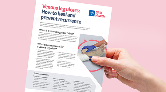 Venous leg ulcer patient handout to download