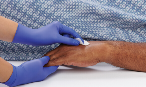 Clinician applies clear protectant to patient’s arm