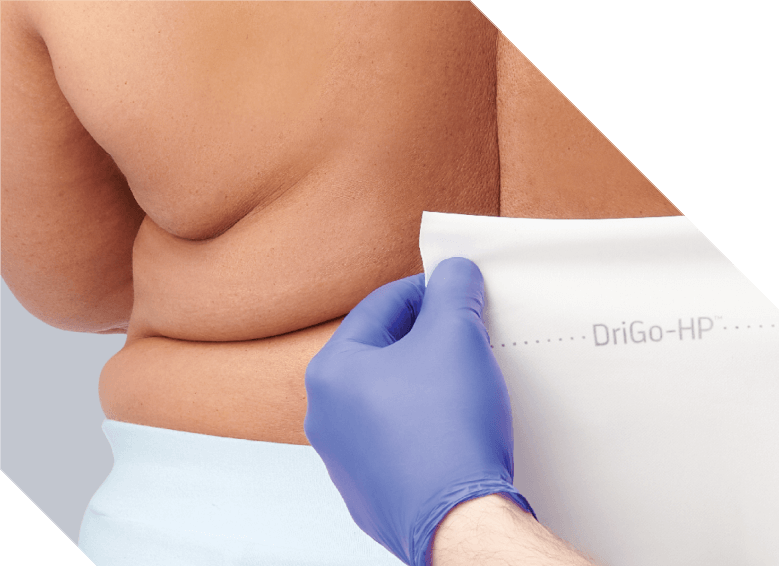 Caregiver’s gloved hand stretching out Remedy DriGo-HP Antibacterial Wicking Sheet in preparation to apply it to patient’s skinfold