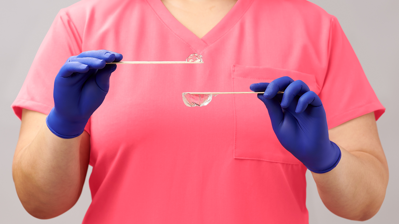 Clinician holds up two spatulas, one containing PluroGel and the other containing a hydrogel.