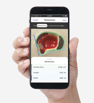 PAP_NE1_Phone_App_326x360.RGB Example of NE1 Wound Management System