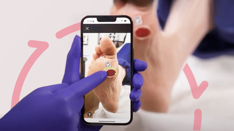 STK_SH_Wound-Photography_RGB Example of NE1® Wound Management System in use