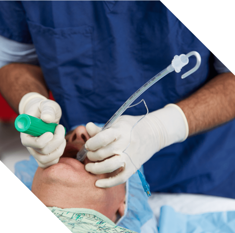 intubating stylet