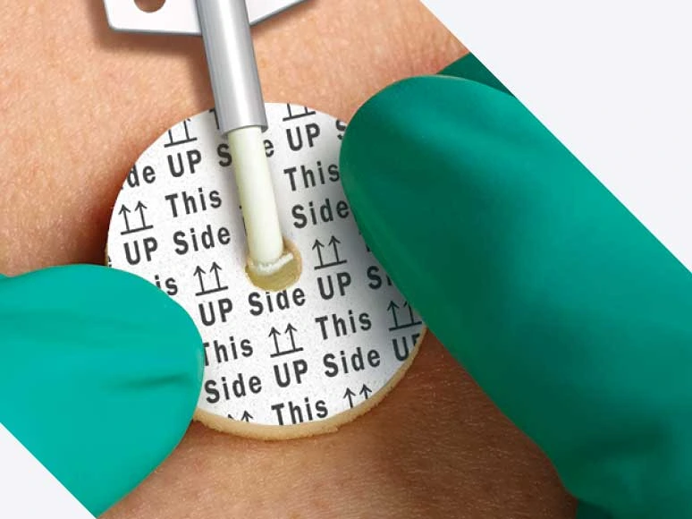 AEGIS CHG impregnated foam disc being placed by gloved fingers