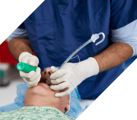 intubating stylet