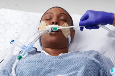 expore_image1 ICU patient receives oral cleanser care delivered on a sponge applicator.