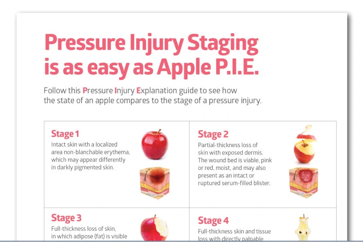 Pressure injury staging poster