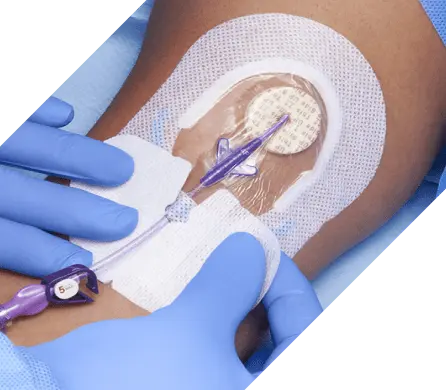 A clinician secures the catheter hub in SorbaView SHIELD device she’s put on a patient’s arm. 