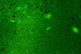 magnified_image1 40x magnification of basic foam dressing showing large presence of biofilm magnified foam dressing