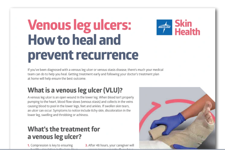 Venous leg ulcers: How to heal and prevent recurrence
