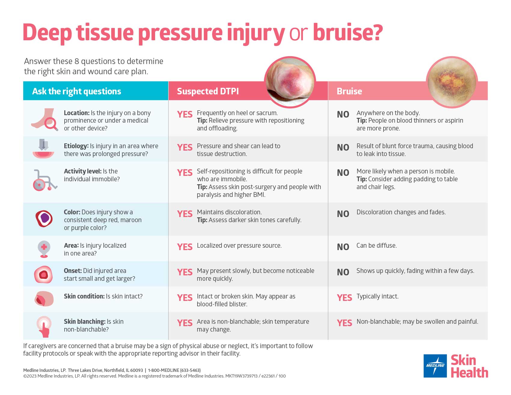 Deep tissue pressure injury or bruise poster