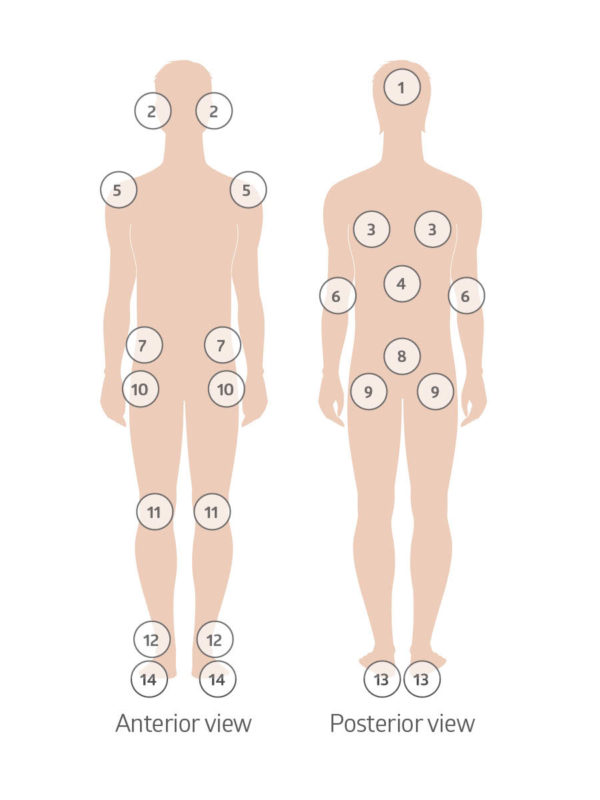 SYM_SkinAssessmentDiagram-600×800