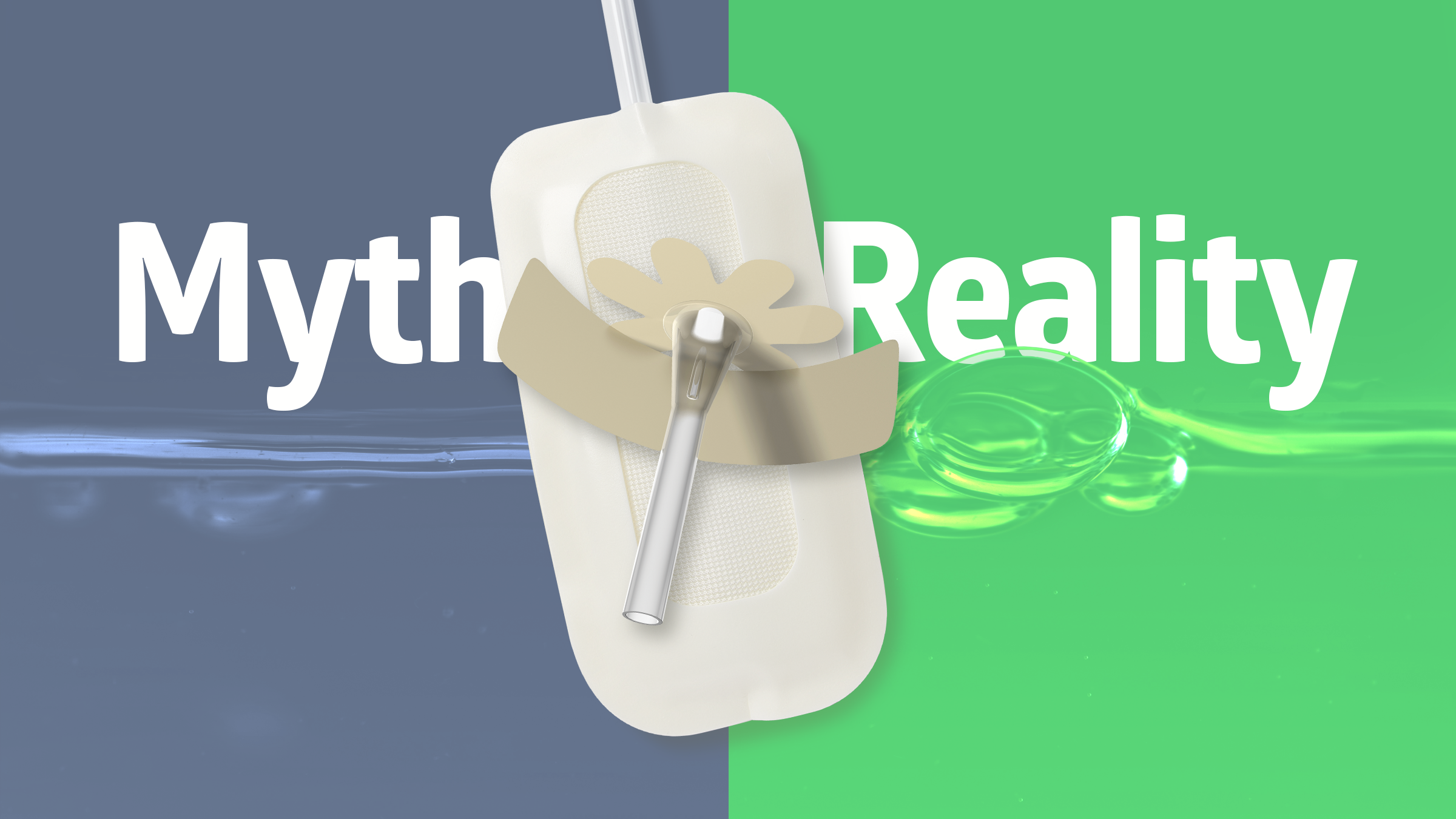 BAN_External catheters myth_RGB External catheters myth versus reality