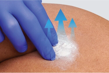 Barrier-cream-for-incontinence Resident lying on stomach looks content as clinician prepares to apply cream to affected area to keep it clean and dry