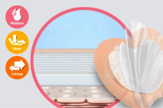 Diagram of skin’s layers next to a 5-layer foam dressing