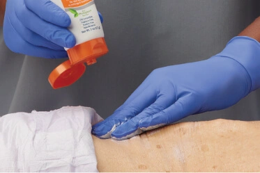Treat-and-prevent-diaper-rash Clinician wears gloves while applying skin barrier cream to diaper area of resident with incontinence