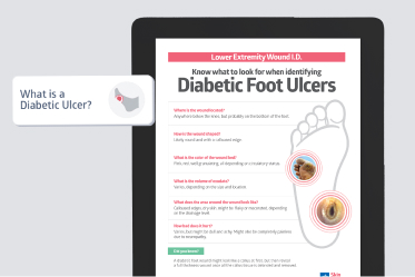 build-nursing-knowledge Educational diabetic foot ulcer poster displayed on tablet