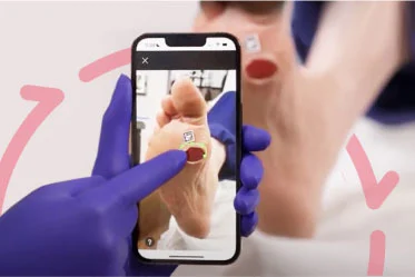Clinician takes a photo with a mobile device of an open wound on patient’s foot 