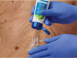skin-moisturized Gloved hands applying Remedy Hydraguard to individual